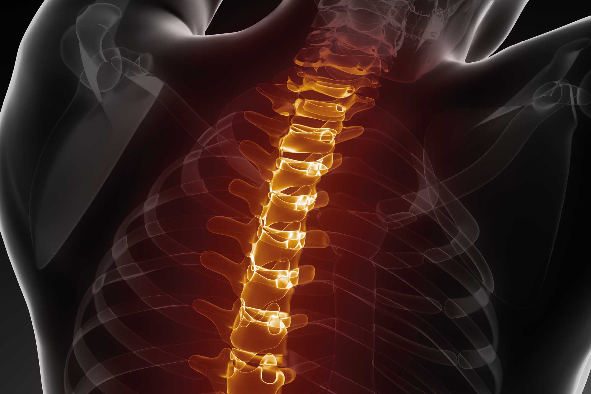 Instituto Neuro Vertebral Recoletas. Clínica Ponferrada.